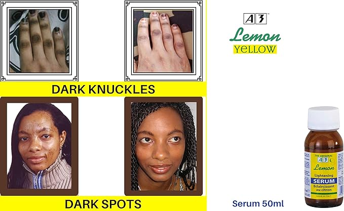 A3 Lemon Serum 50ml lightening serum for dark knuckles and spots