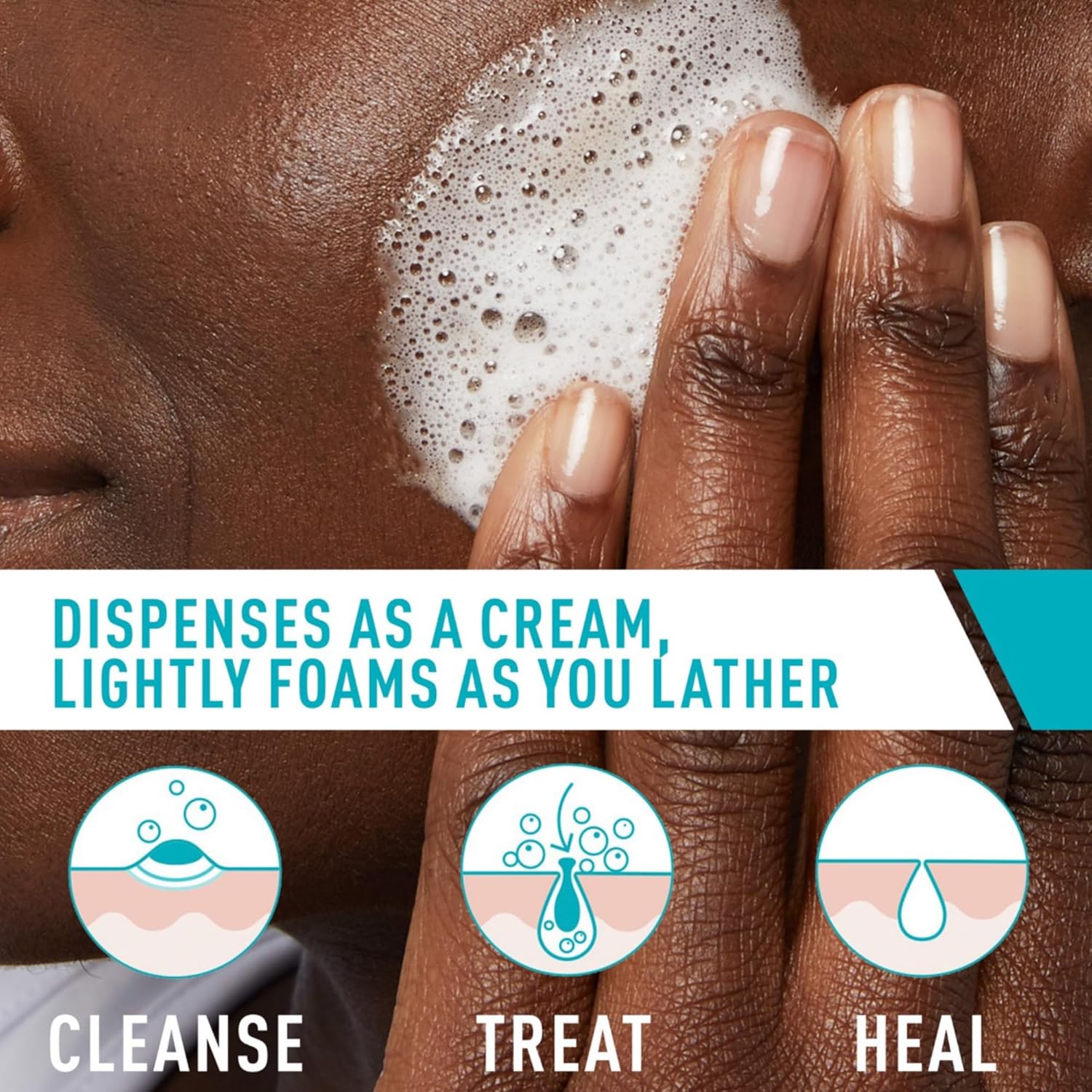 CeraVe Acne Foaming Cream Cleanser 150ml for oily and acne-prone skin