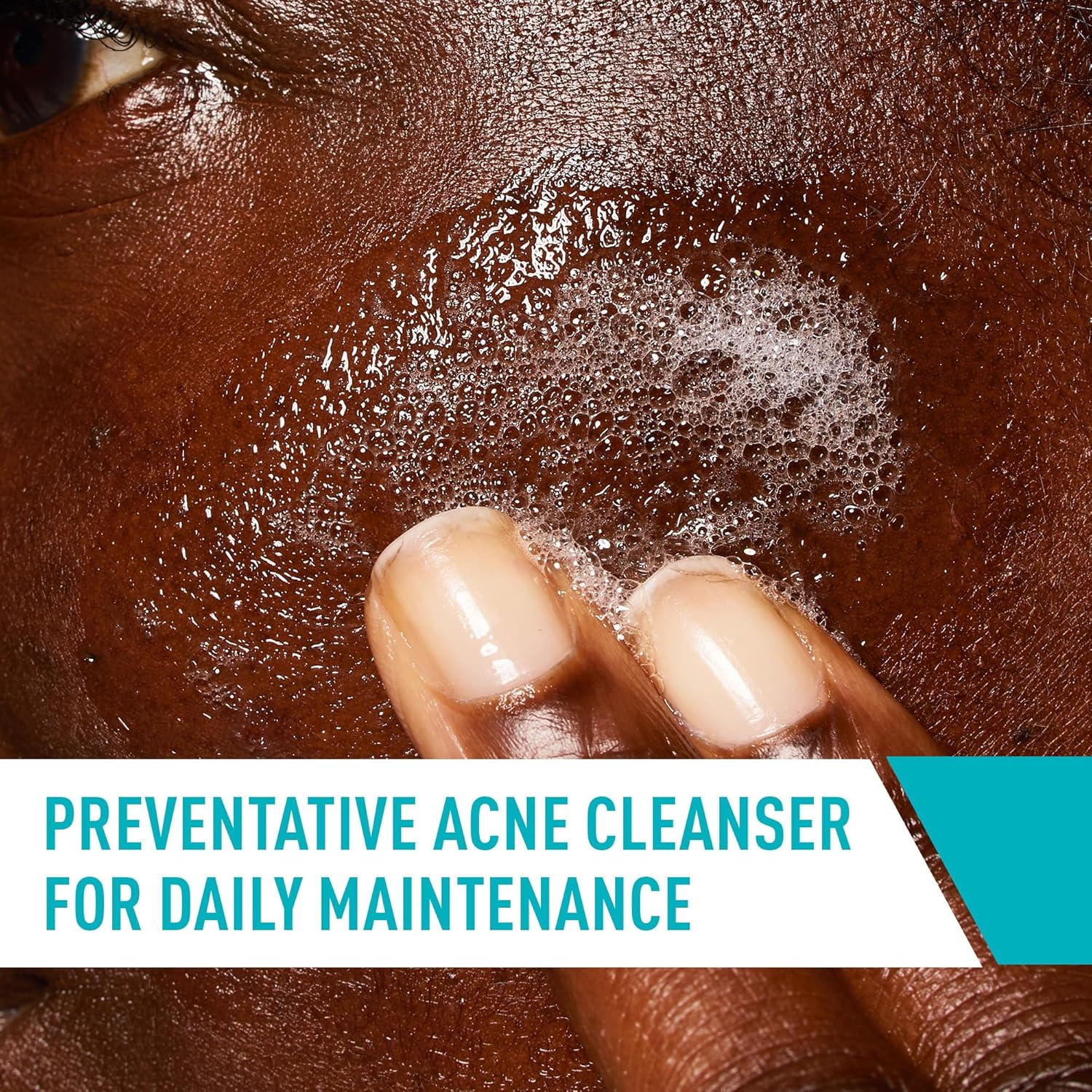 CeraVe Acne Control Cleanser 237ml foaming cleanser on wet skin