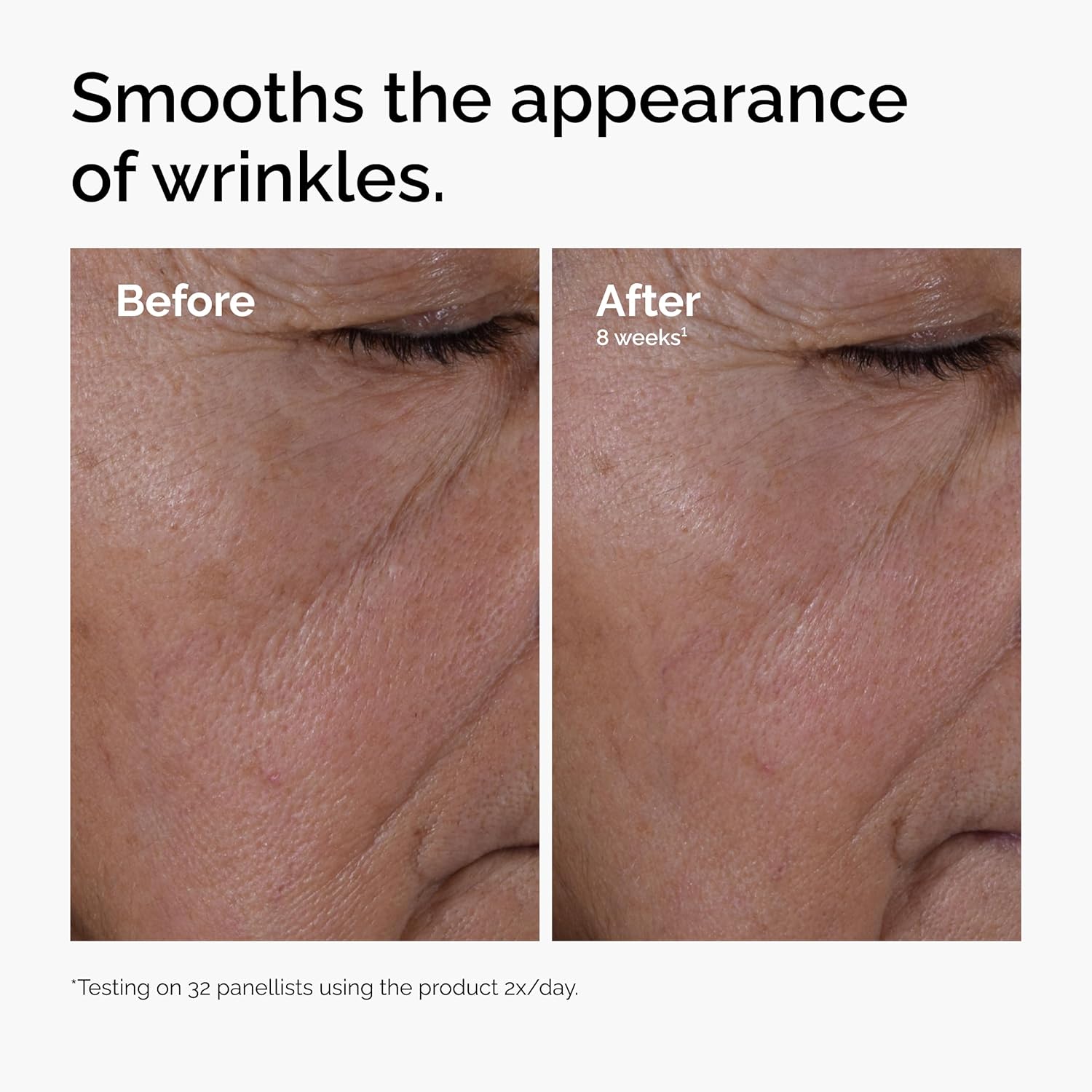 The Ordinary Multi-Peptide + HA Serum 30ml bottle for wrinkle reduction