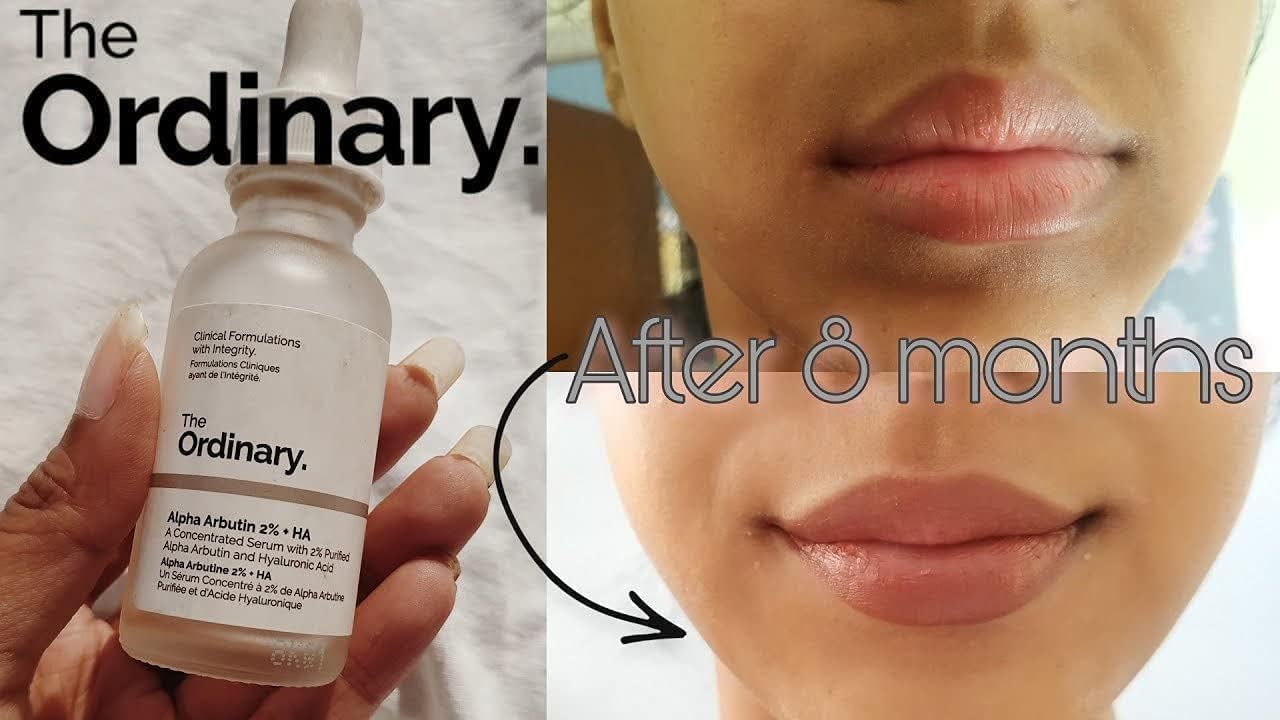 The Ordinary Alpha Arbutin 2% plus HA concentrated serum bottle