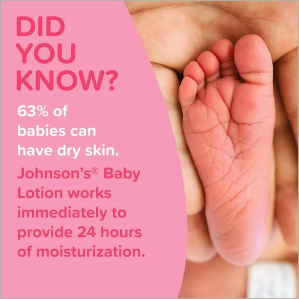 Johnson's Baby Lotion 300mL moisturiser for infant skin care