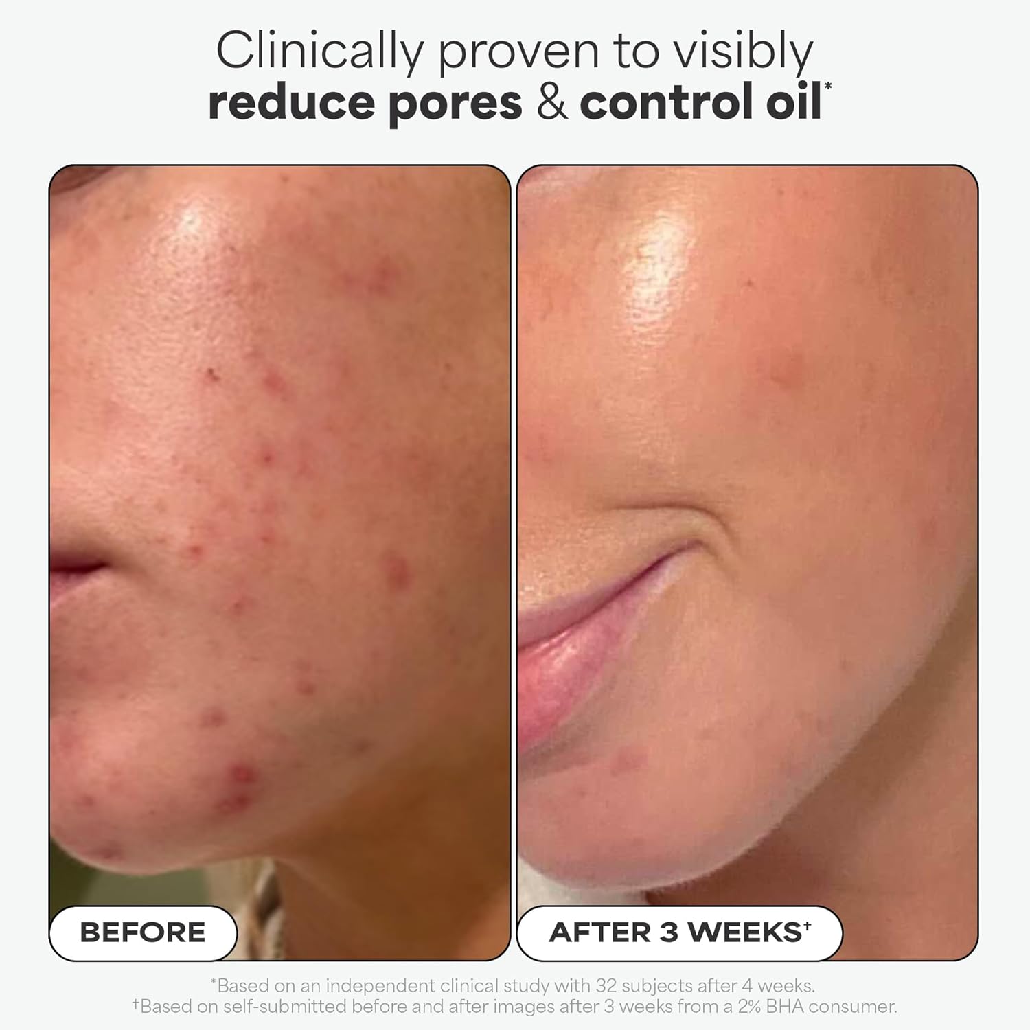 Paula's Choice Skin Perfecting 2% BHA Liquid Exfoliant 30ml bottle