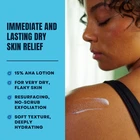 Intensive Healing Body Lotion for extremely dry skin therapeutic formula