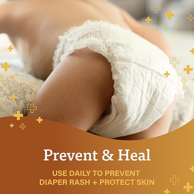 A + D Baby Diaper Rash Ointment 4oz with Vitamins A and D