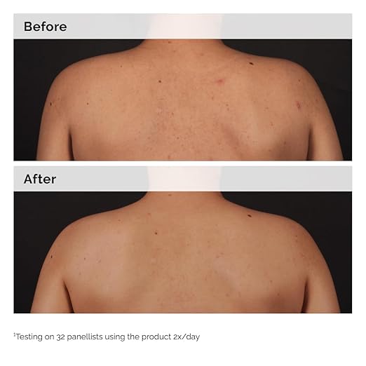 The Ordinary Salicylic Acid 0.5% Body Serum 240ml bottle