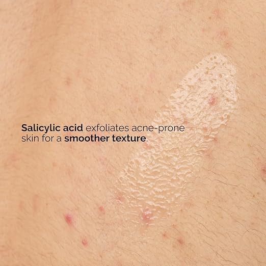 The Ordinary Salicylic Acid 0.5% Body Serum 240ml exfoliating treatment